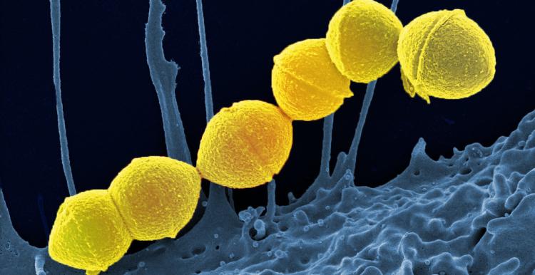 Group Strep A (Credit:National Institute of Health - resized)